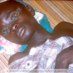 Patient with the Ebola virus